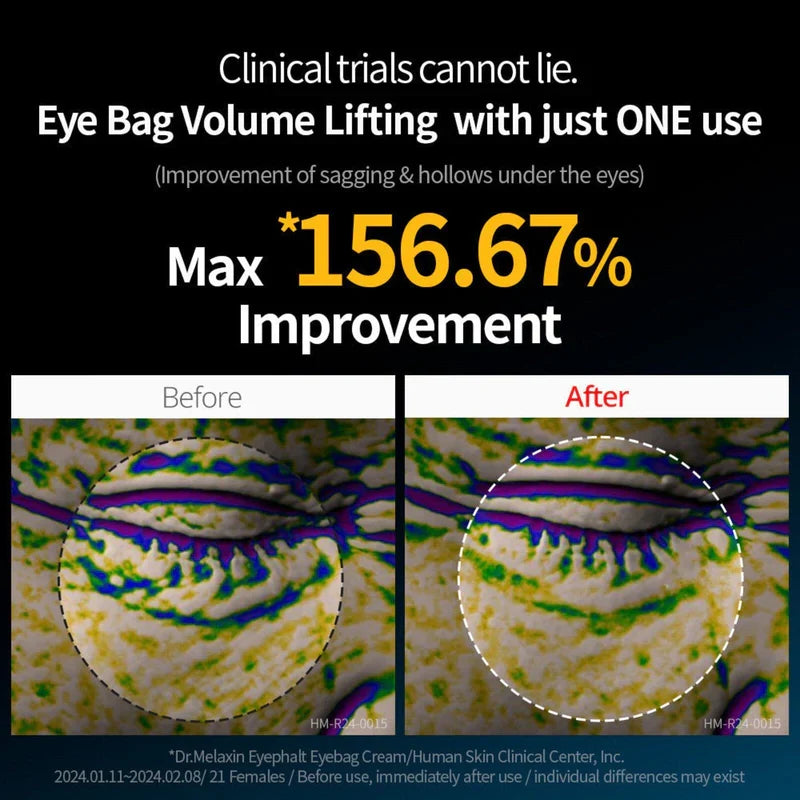 Dr Melaxin - Eyephalt Eyecream(free shipping)
